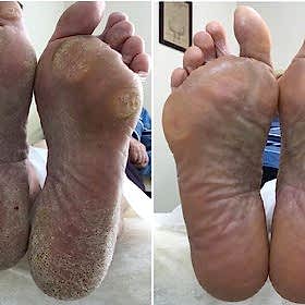 Педикюр - работы выпускников студии Relaks Me