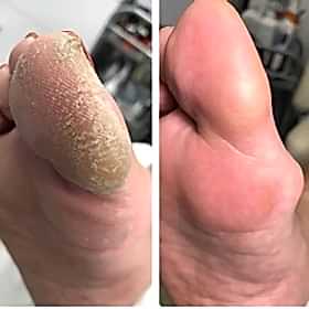 Дисковый педикюр - работы выпускников