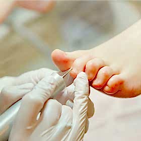 Аппаратный педикюр