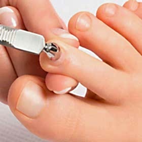 Детский педикюр