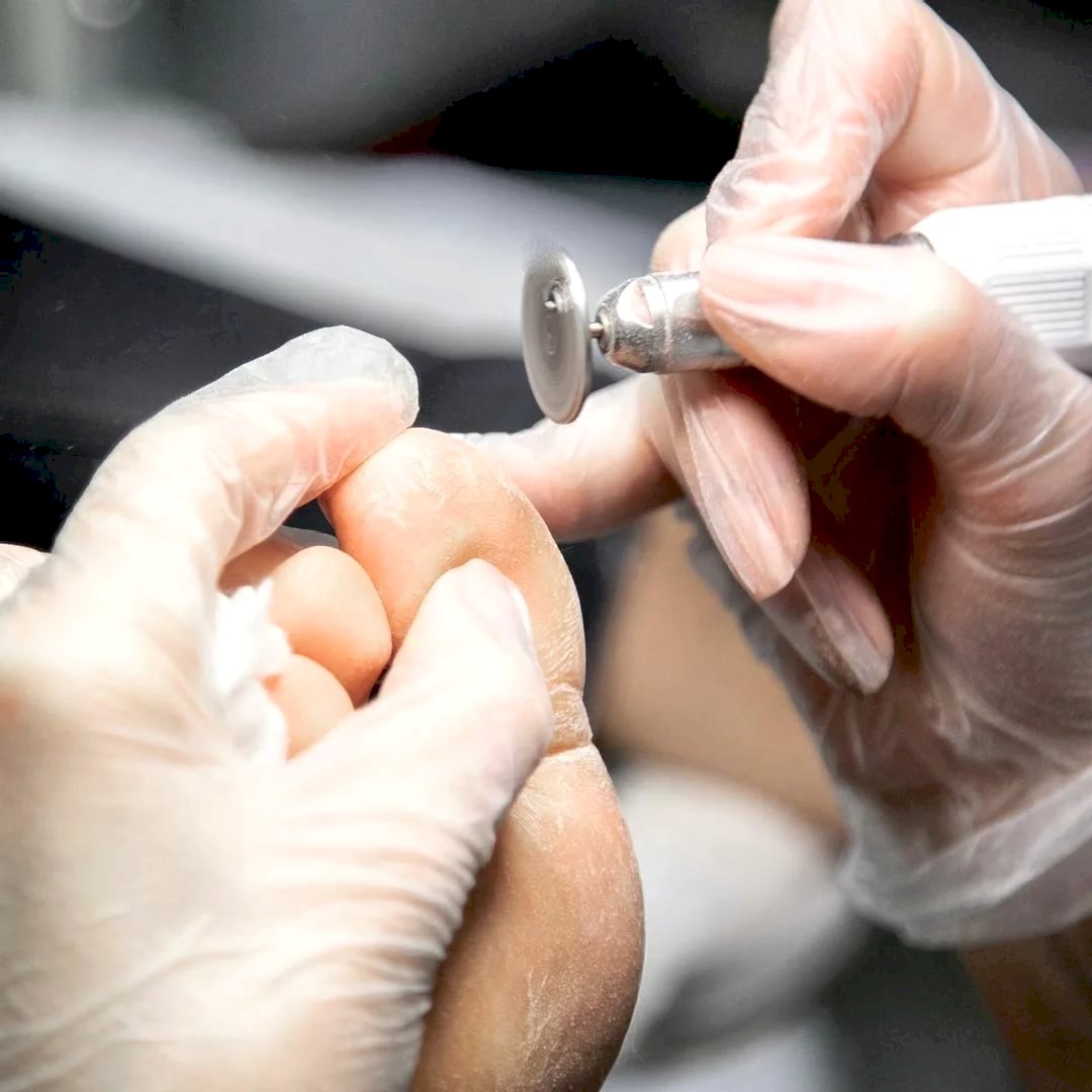 Дисковый педикюр